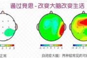 无锡竞思告诉你孩子自闭了你要注意这几点
